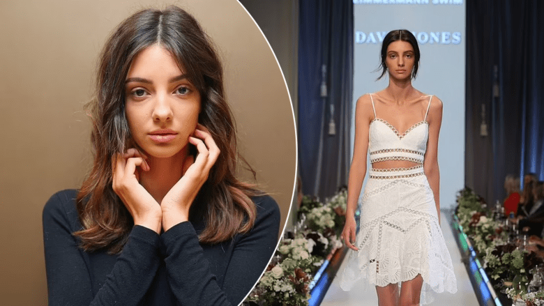Ndahet nga jeta në moshën 27-vjeçare modelja Lucy&nbsp;Markovic